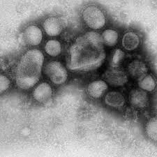 Pandemia 2009 H1N1