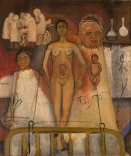Frida y la cesárea (1931)